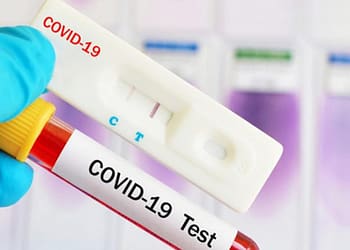 cual-es-la-diferencia-entre-una-prueba-pcr-y-antigenos