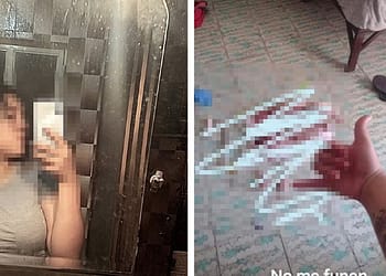 Quién es Yara Fruut Loops La joven señalada por asesinar a un gato en Aguascalientes portada