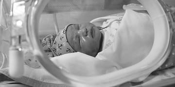 Los bebés son especialmente susceptibles a las infecciones durante los primeros 28 días de vida. Foto. Pixabay.