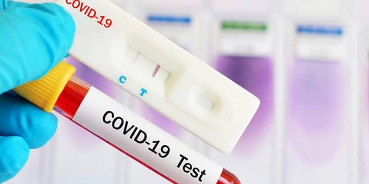 cual-es-la-diferencia-entre-una-prueba-pcr-y-antigenos