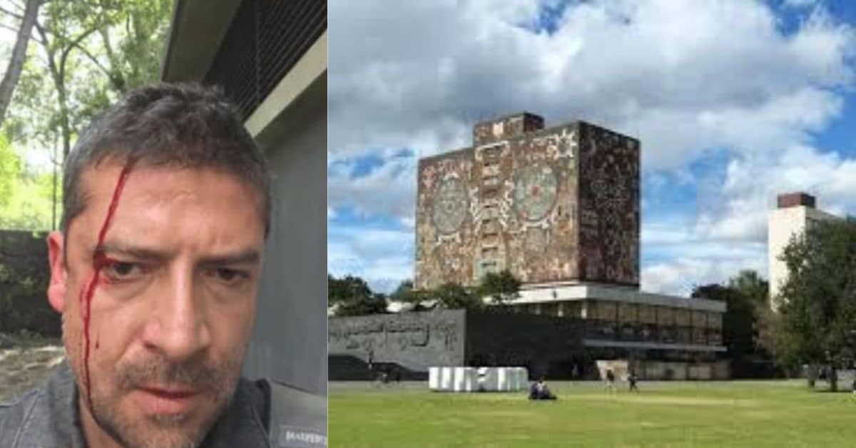 Unam agredido humberto padgget 