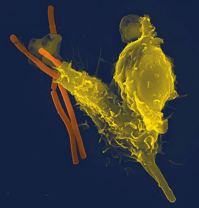 virus viruela covid antrax china estados unidos