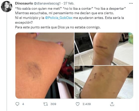 Los vecinos de Diana la hostigan y agreden; las autoridades la ignoraron 7